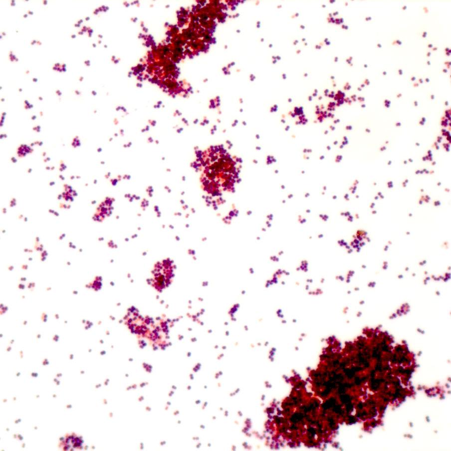 Soluciones de microscopía para microbiología