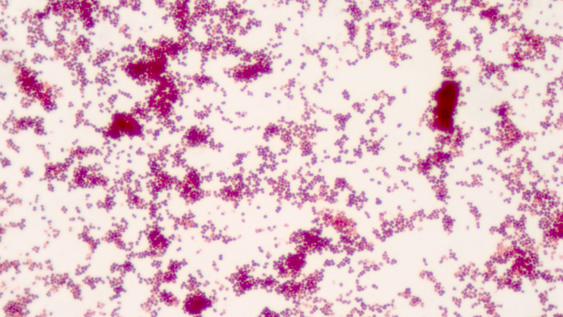 Microscopic view of bacteria, fungi, and parasites in body fluids or cultures
