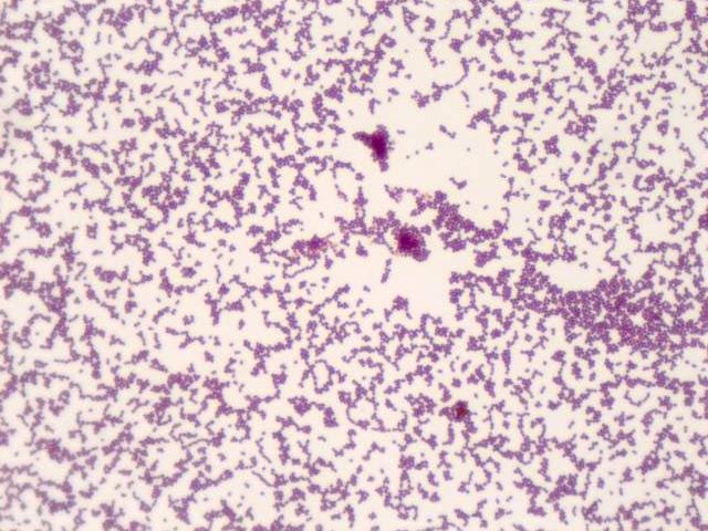 Staphylokokken-Bakterien, Gram-Färbung, Gram-positiv, 100-fach, Öl-Objektiv. Aufgenommen mit ZEISS Axio Lab.A1