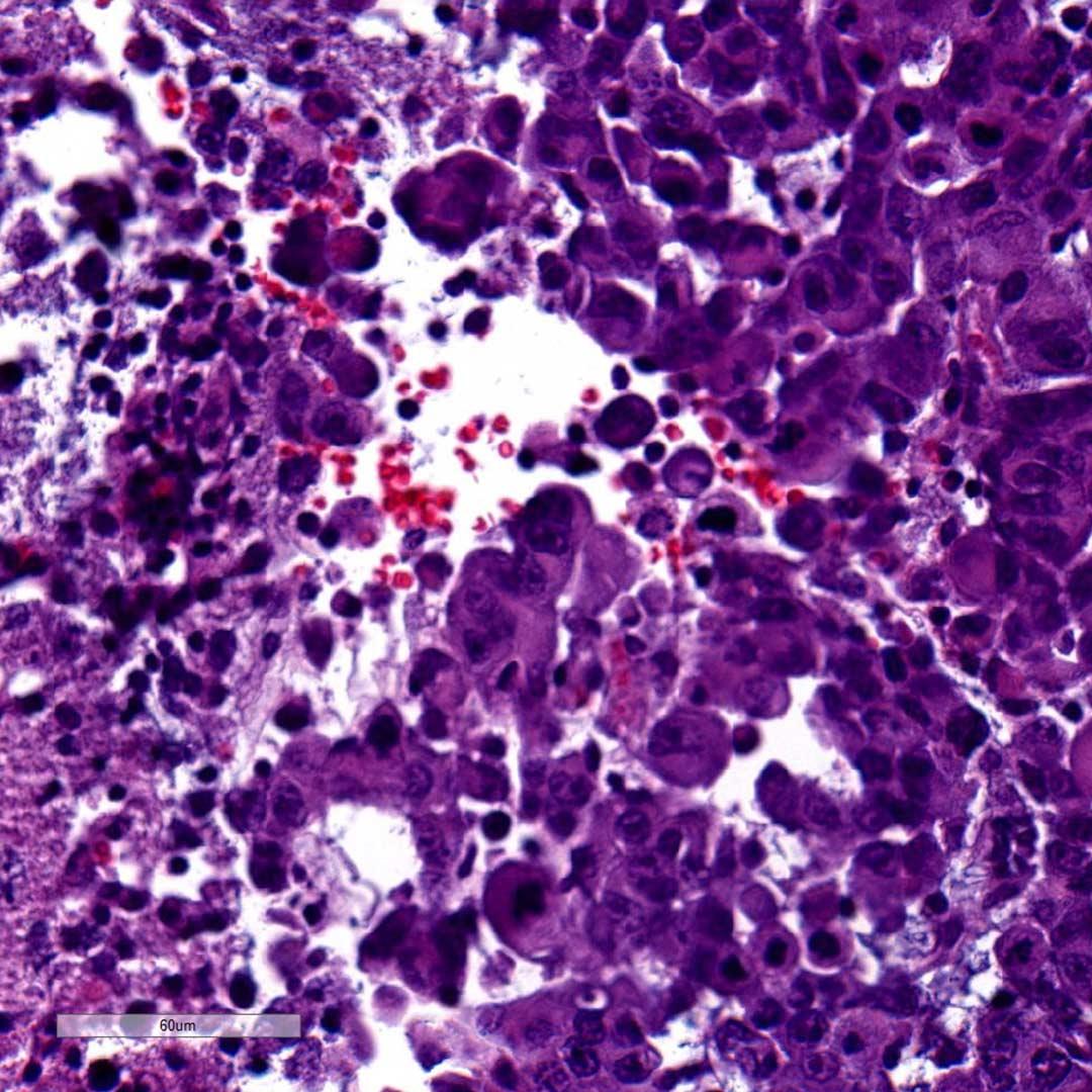 Soluciones de microscopía para neuropatología