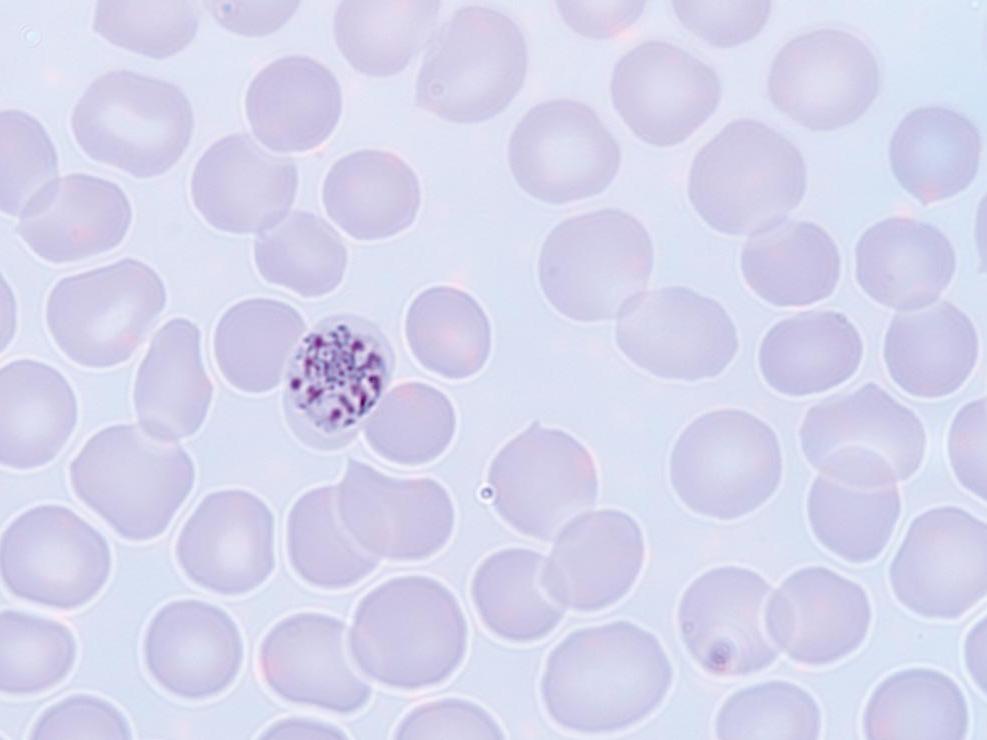 Plasmodium malariae im Hellfeld. Aufgenommen mit ZEISS Axiolab.A1