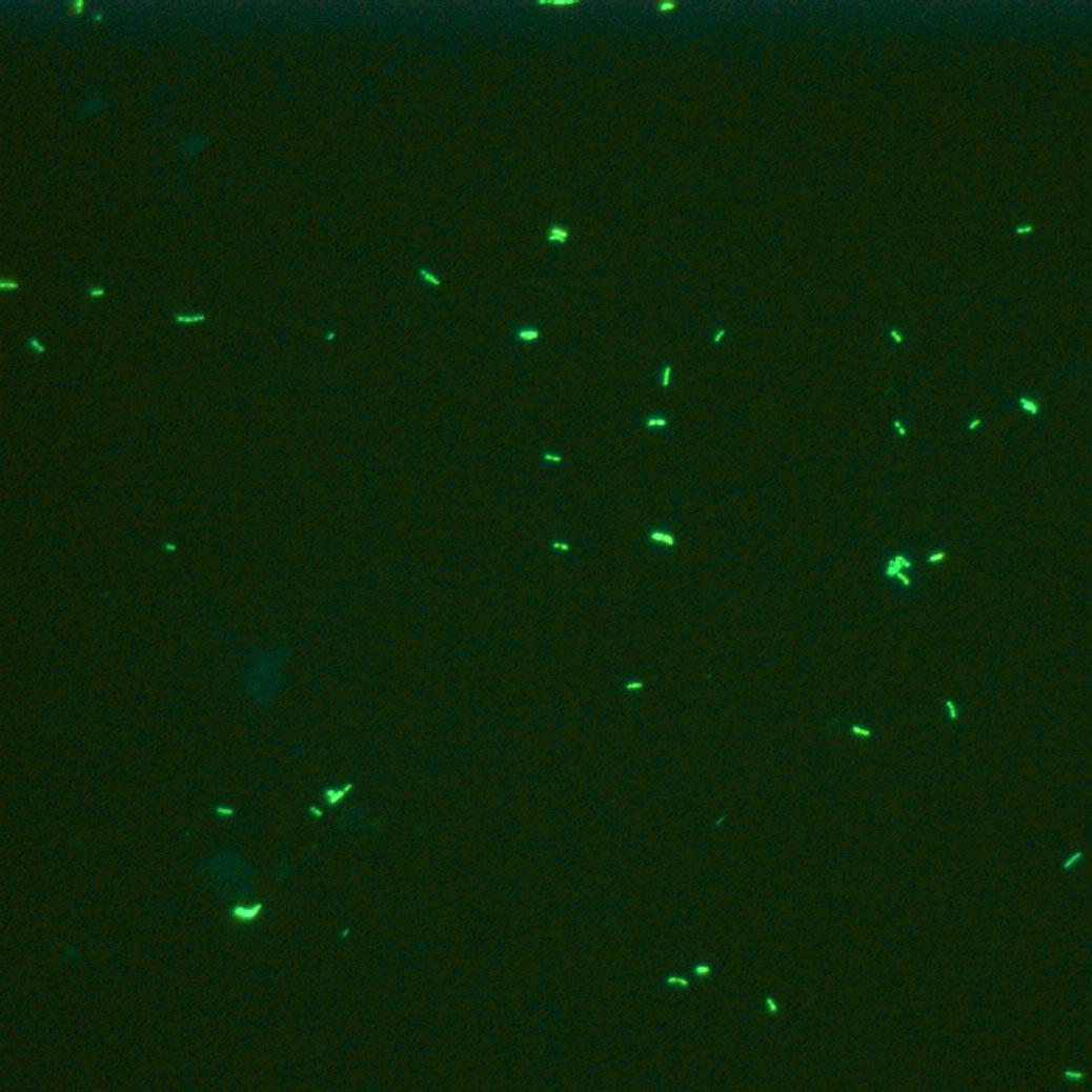 Solutions de microscopie pour soins de santé primaires