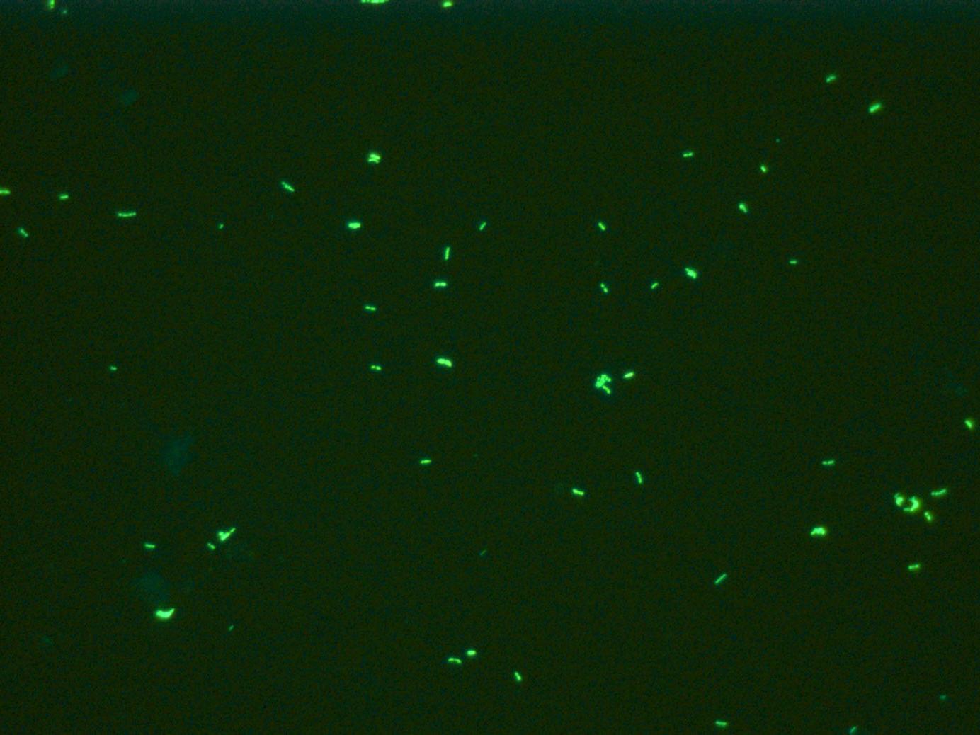 Tinción de auramina de tuberculosis de Mycobacterium, contratinción de azul de metileno, captura de imágenes de fluorescencia, captadas con ZEISS Primostar iLED.