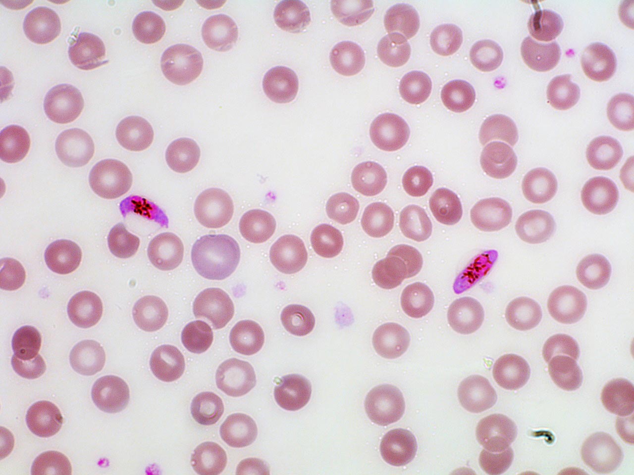 Plasmodium falciparum. Image capturée avec ZEISS Axiolab.A1