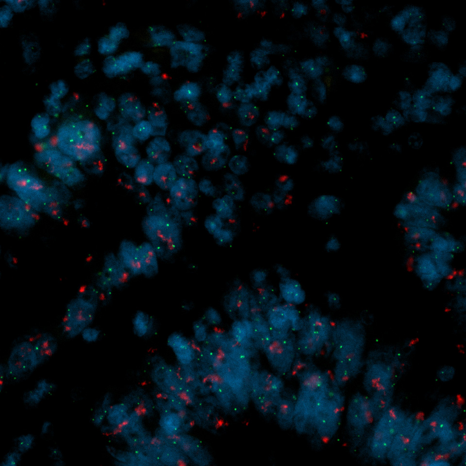Fluorescently labeled DNA/RNA probes to detect specific genetic sequences.