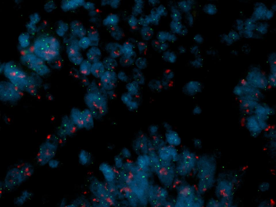 Fluorescently labeled DNA/RNA probes to detect specific genetic sequences.