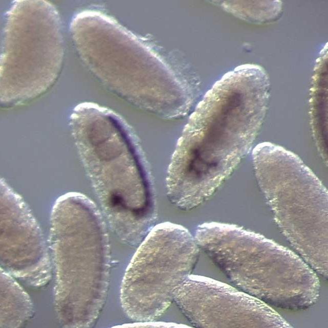 Soluciones de microscopía para la preparación de muestras