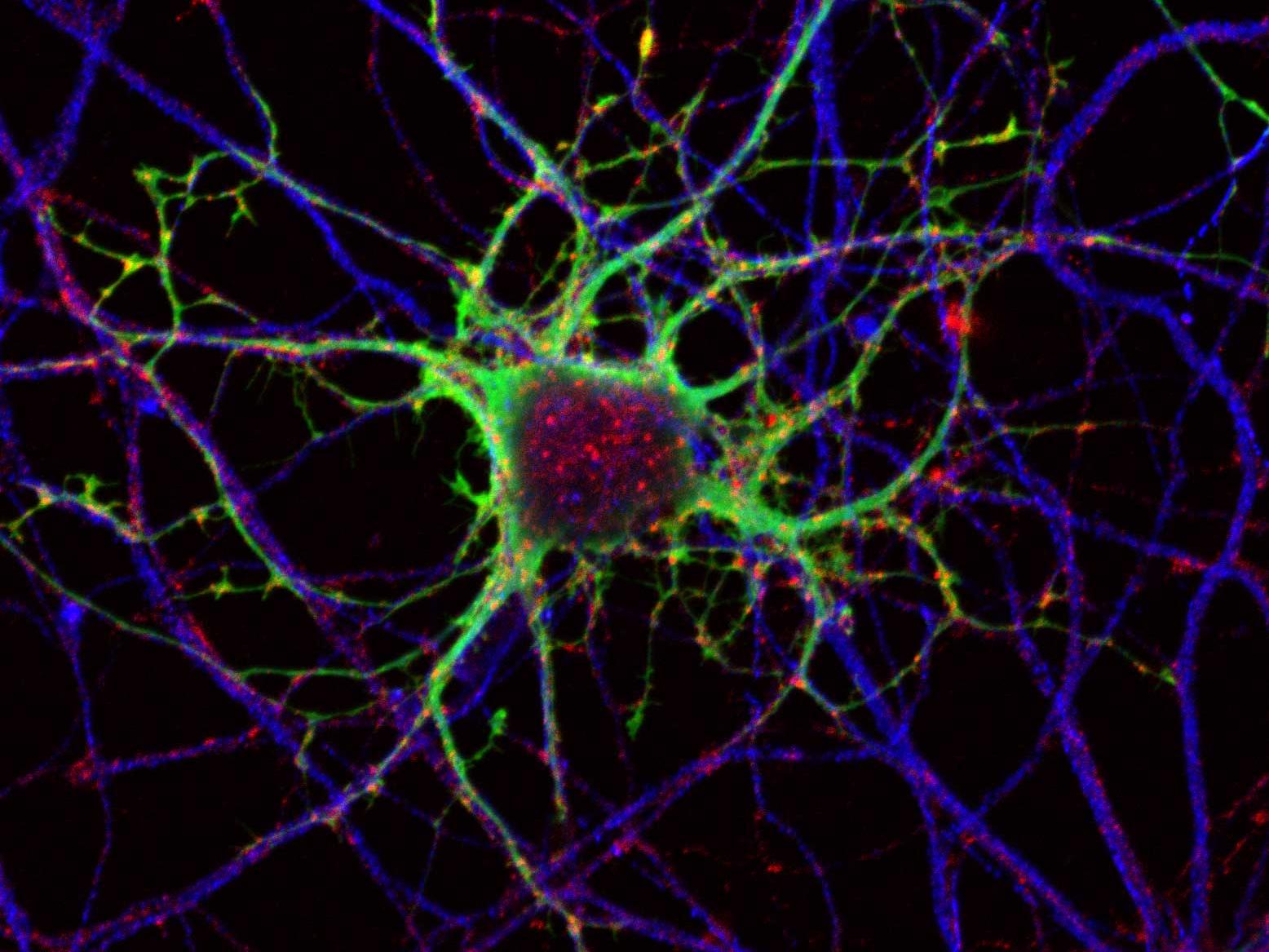 Cultures neuronales primaires colorées pour les antigènes de Bornavirus et la toxine tétanique