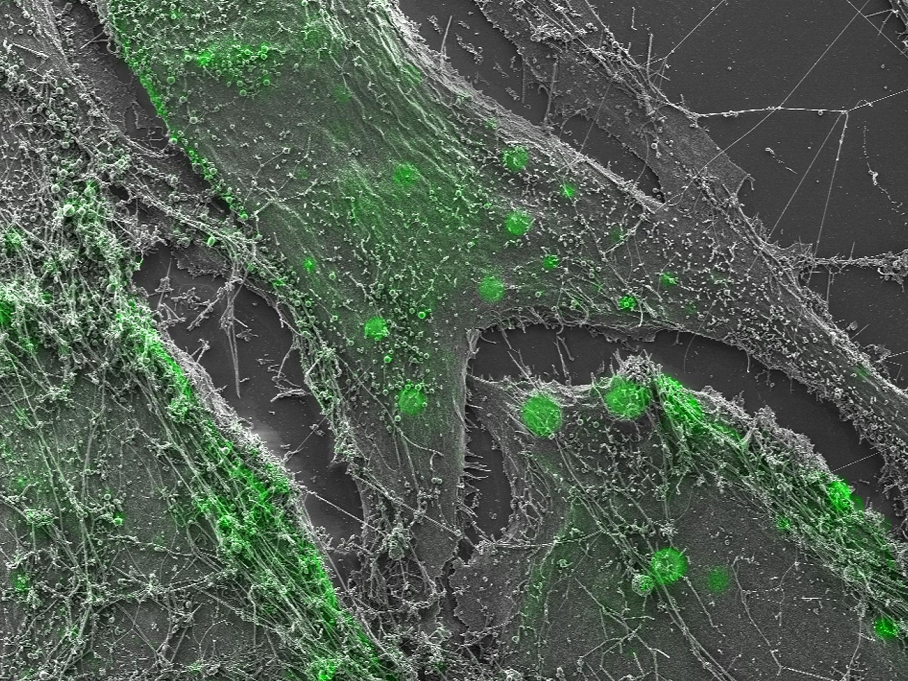 Distribution intracellulaire et membranaire des cytomégalovirus marqués GFP