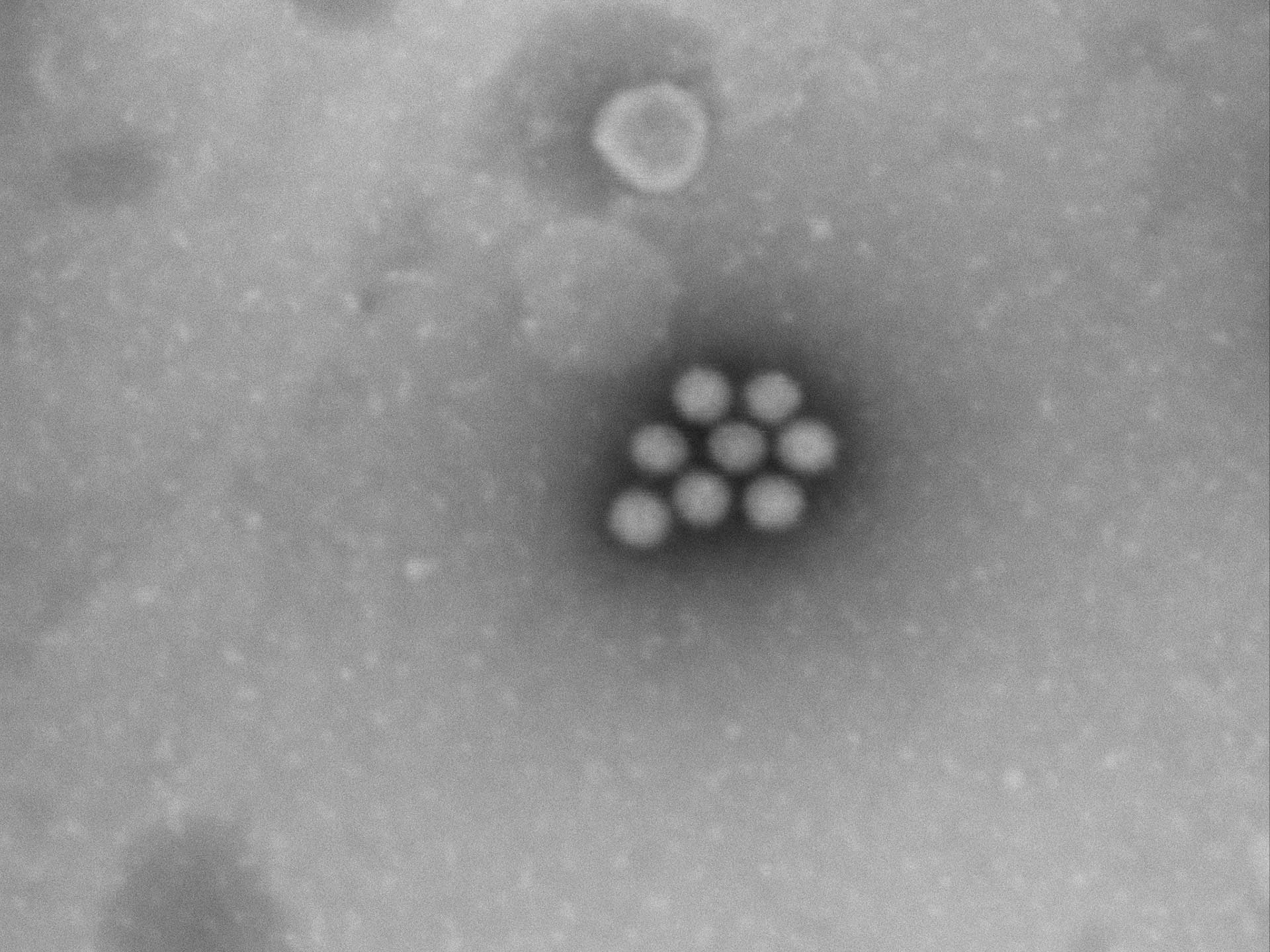 La forme caractéristique des cellules les identifie comme des cellules de rotavirus.