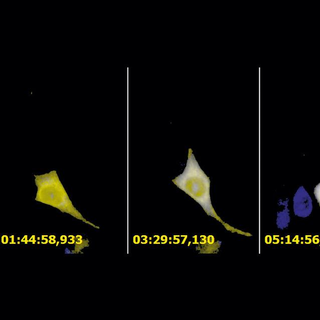 Copyright: H.Wolff, Instituto GSF de Virología molecular, Neuherberg, Alemania