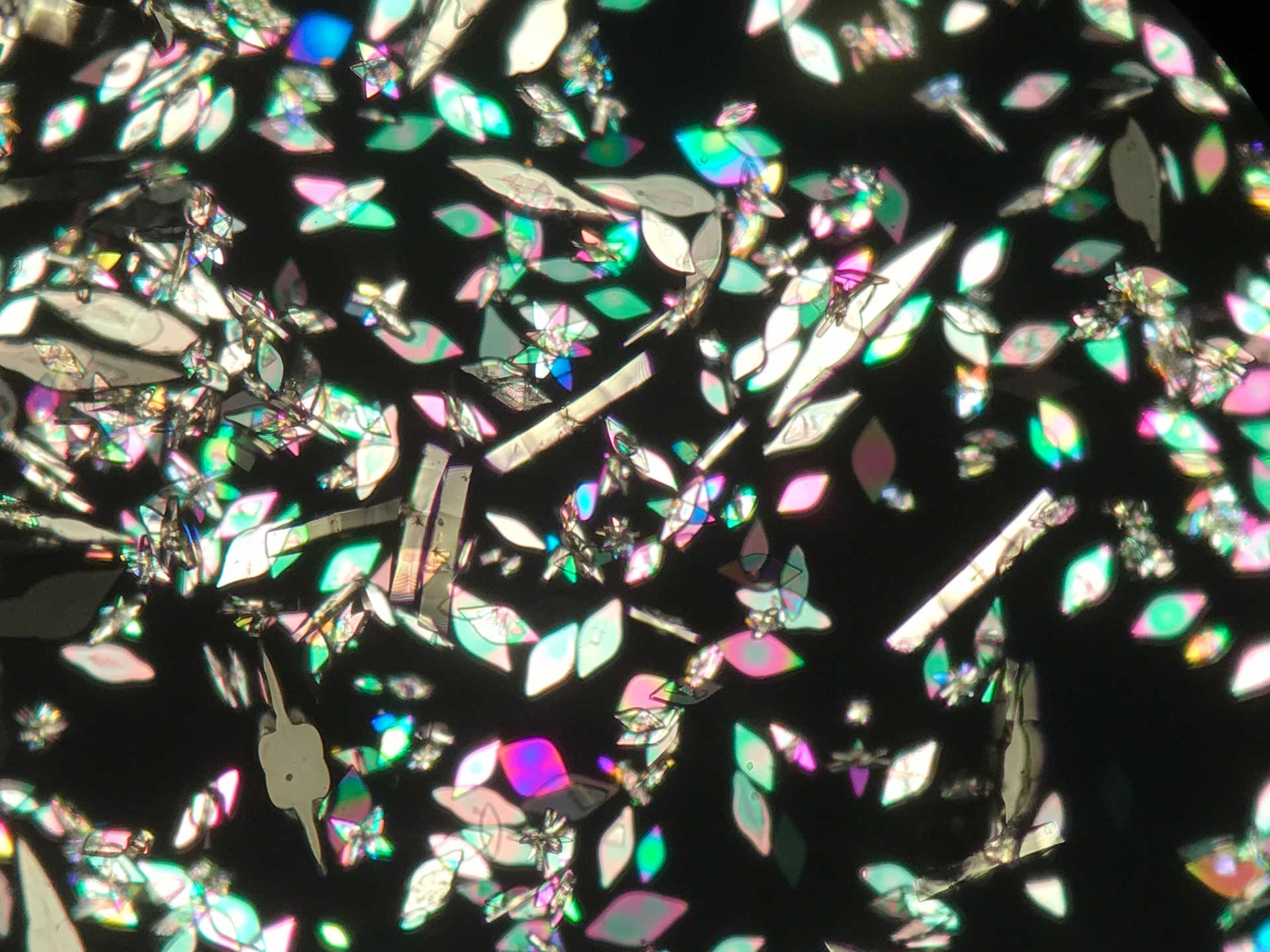 Microscopic view of crystals in urine