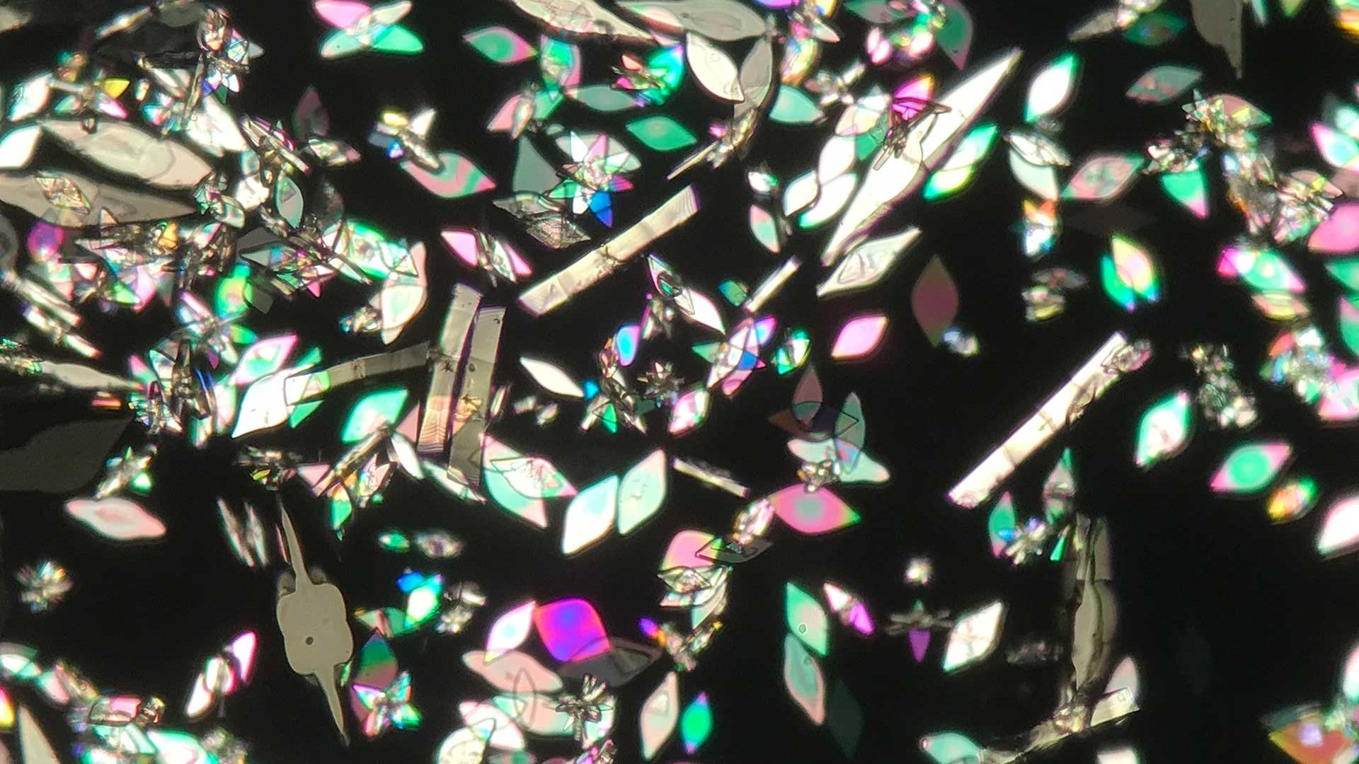 Microscopic view of urine