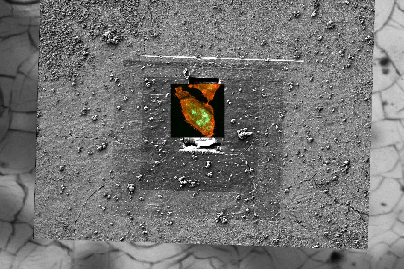 Tauchgefrorene Adenokarzinomzellen auf Saphirscheiben.