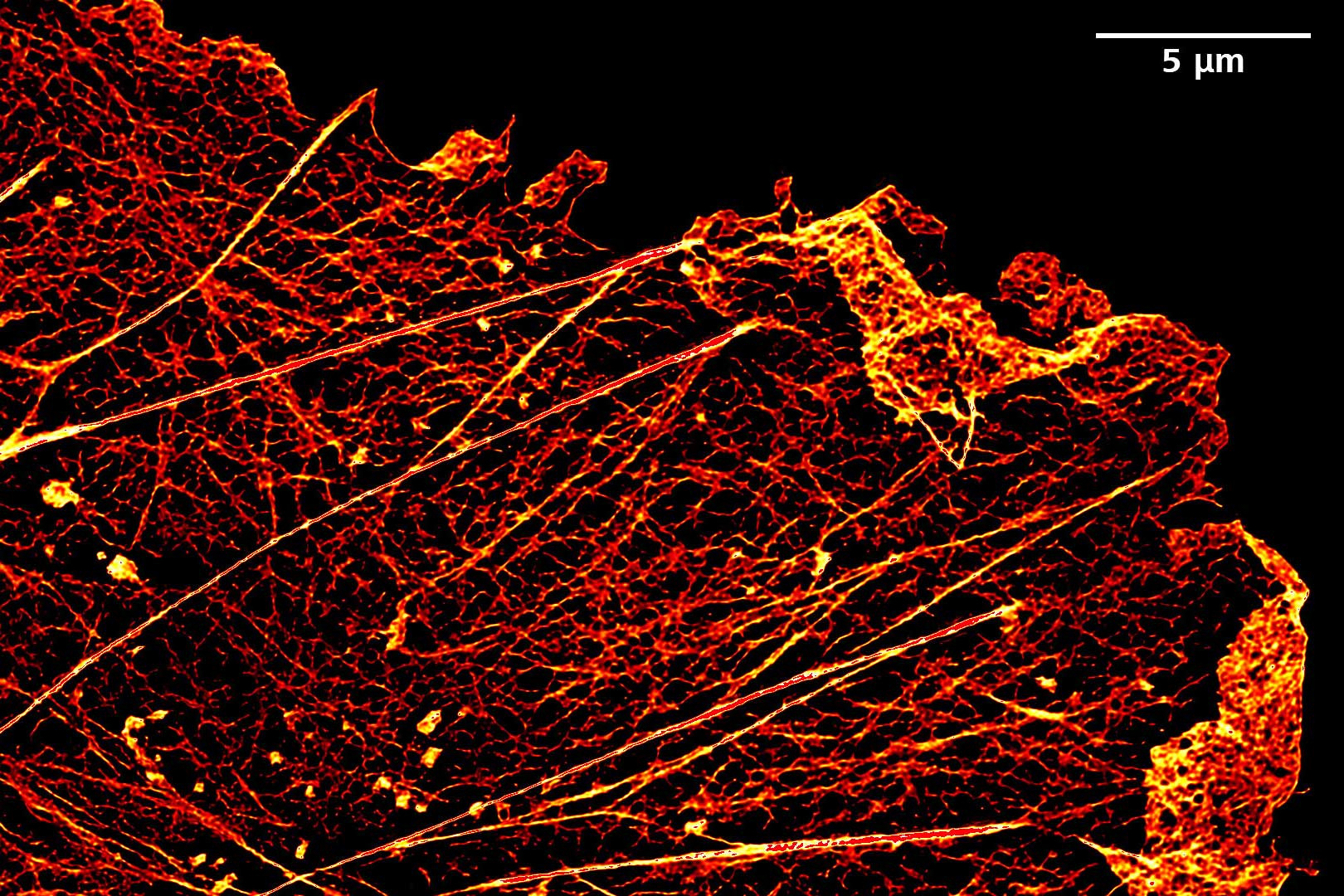 Imagen de Lattice SIM² de células Cos-7 marcadas con faloidina Alexa 488