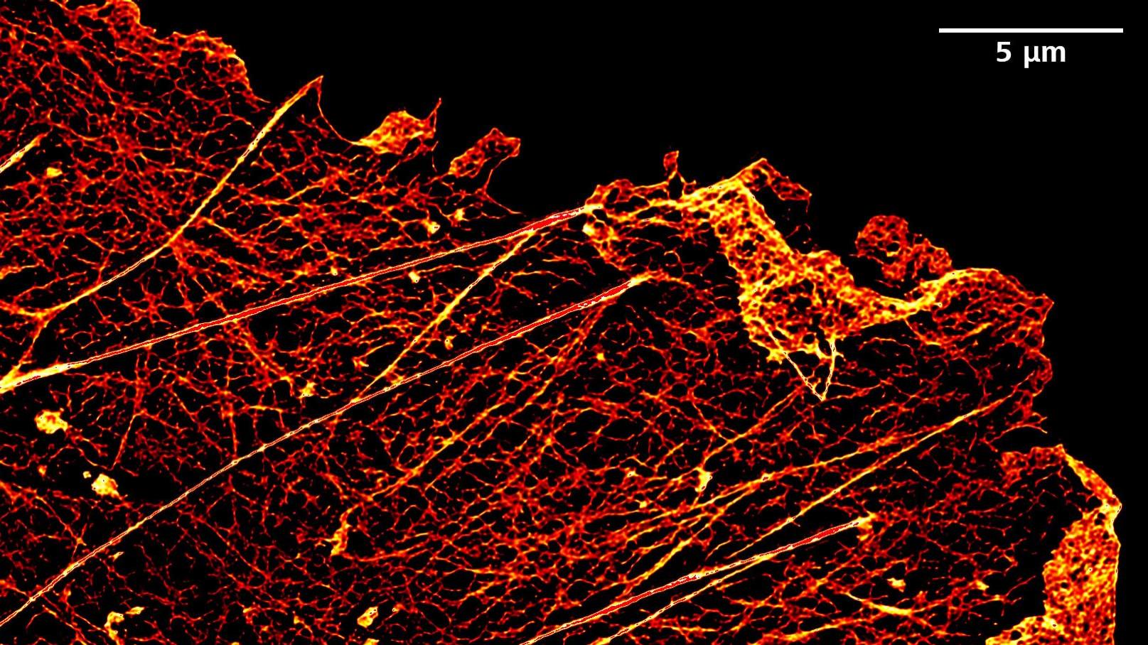 Imagen de Lattice SIM² de células Cos-7 marcadas con faloidina Alexa 488