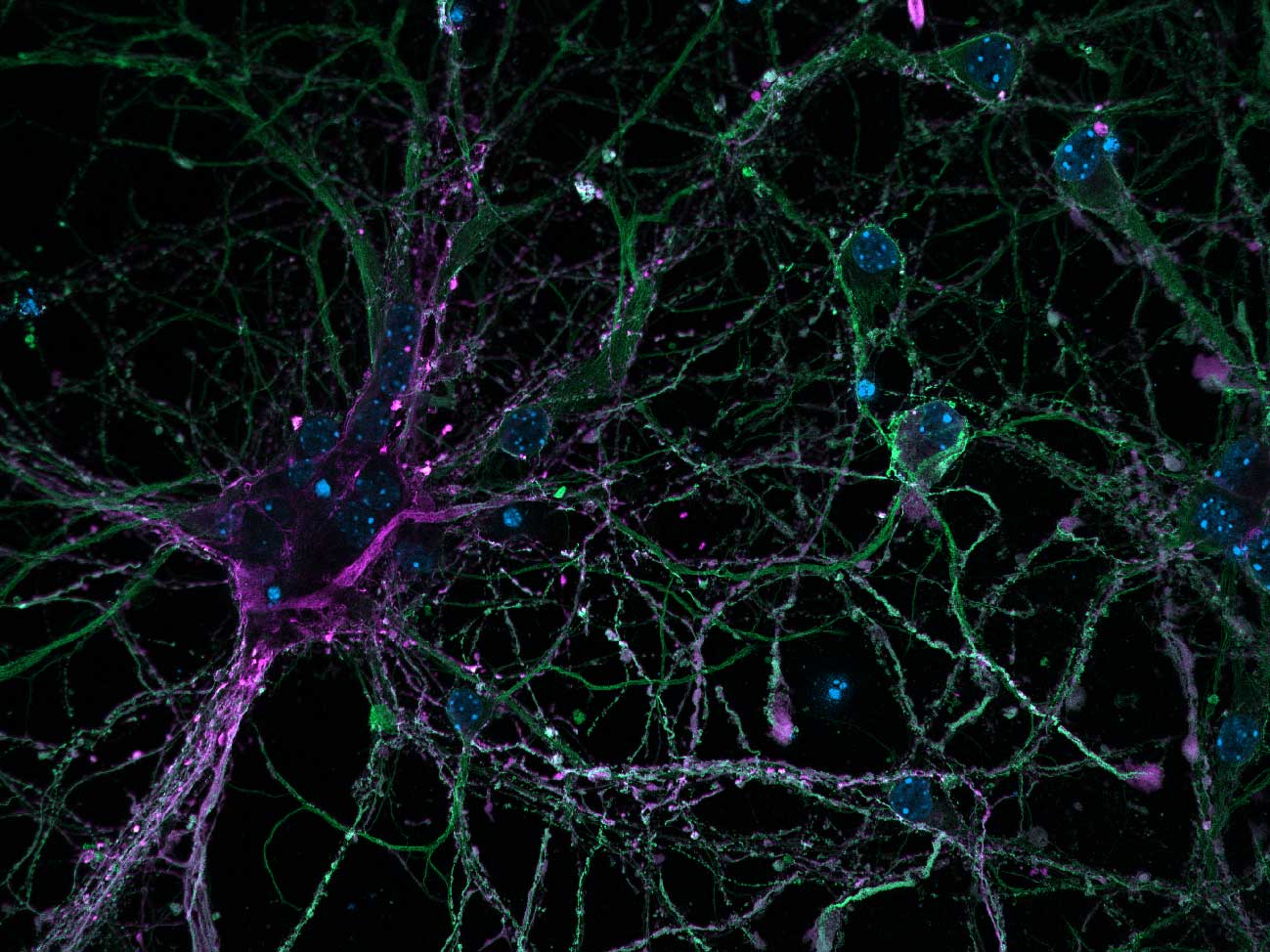 Cortical neurons stained for DNA, microtubules and microtubule-associated proteins 