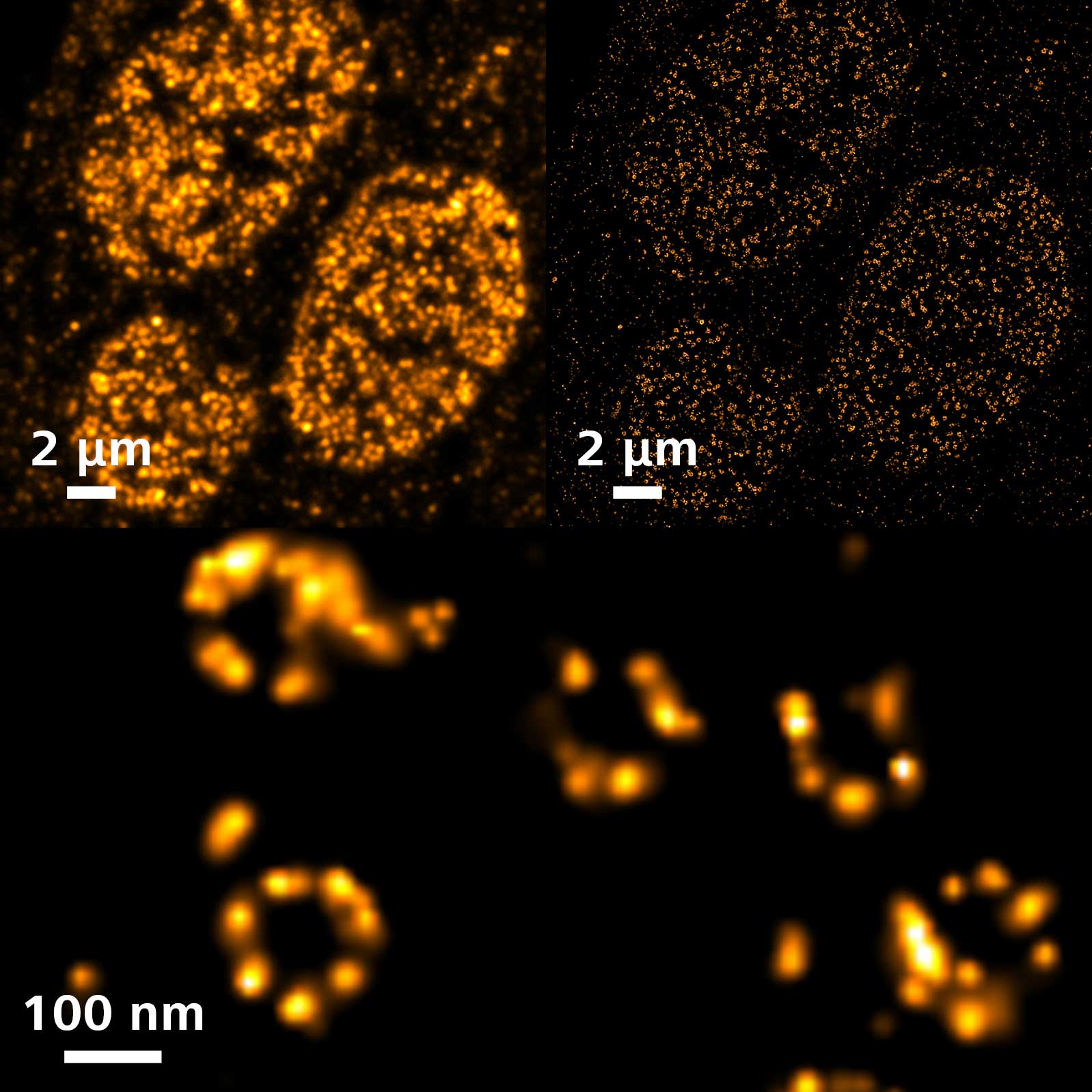 アフリカツメガエル腎臓由来A6細胞の8回対称位置にある核膜孔複合体。Alexa Fluor 647で標識されたGp210。