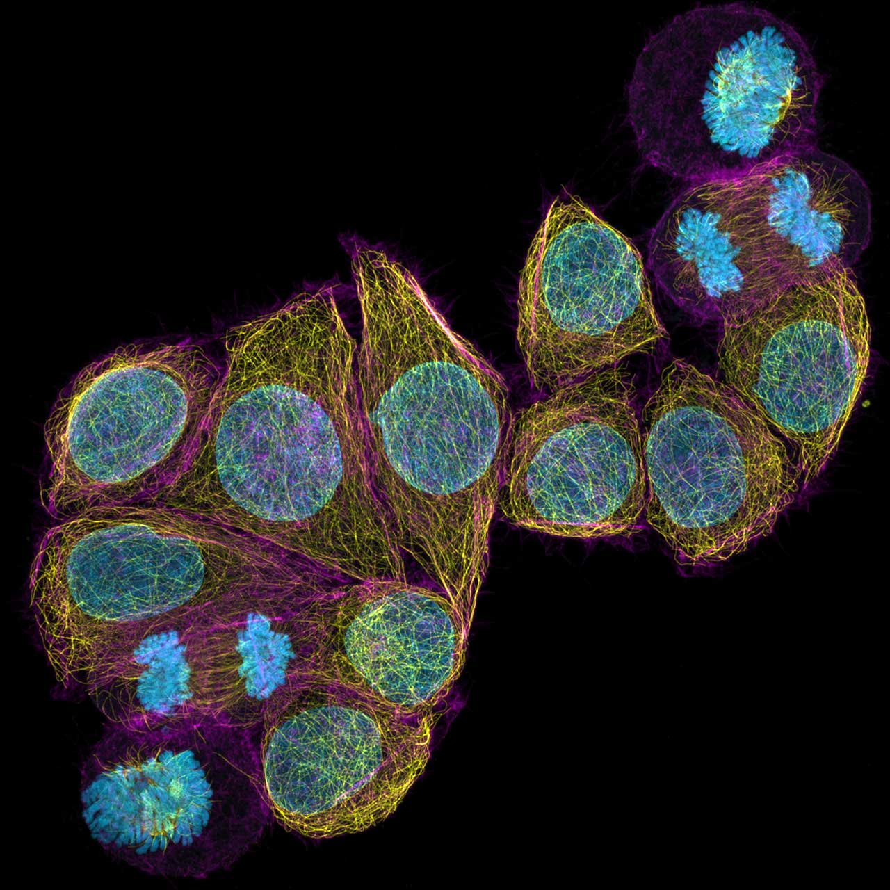 Großes Sehfeld mit HeLa-Zellen in Superauflösung. Mit freundlicher Genehmigung von A. Politi, J. Jakobi und P. Lenart, Max-Planck-Institut für biophysikalische Chemie, Göttingen, Deutschland.