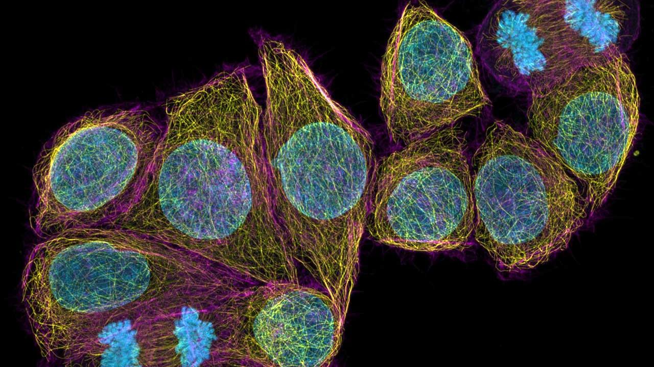 Captura de imágenes con superresolución de un campo de visión grande de células HeLa. Cortesía de A. Politi, J. Jakobi y P. Lenart, MPI para química biofísica, Göttingen, Alemania.