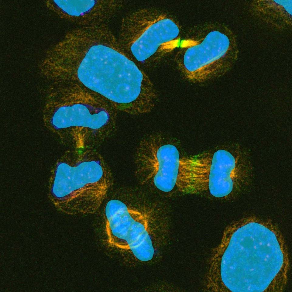 Cell nuclei segmentation based on conventional image analysis methods