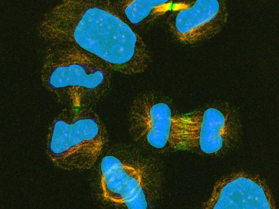 Segmentation des noyaux cellulaires basée sur des méthodes conventionnelles d'analyse d'images