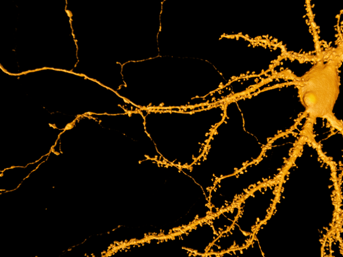A neuron cell is traced and marked in a microscopy image. Dendritic spines are differentiated and segmented in blue while the neuron cell body and neurite branches are segmented in orange.