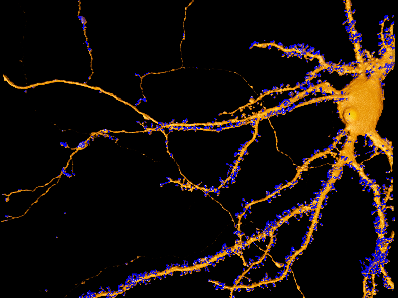 A neuron cell is traced and marked in a microscopy image. Dendritic spines are differentiated and segmented in blue while the neuron cell body and neurite branches are segmented in orange.