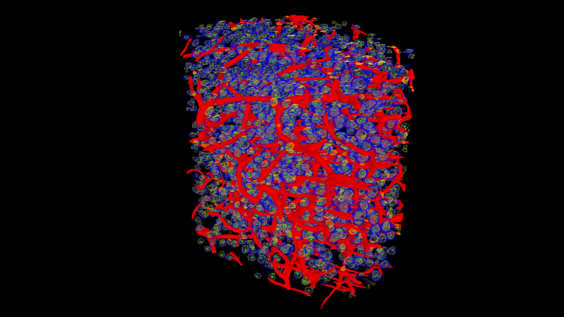 Image analysis results in a 3D view of X-ray microscopy image. The segmentation highlights brain blood vessels (red), the nucleolus (green) within the nucleus (yellow), and the soma (blue).