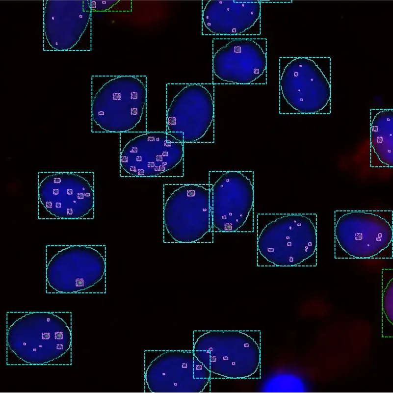 Within each nucleus that is seen in dark blue, nuclei are highlighted in cyan and foci in magenta. 