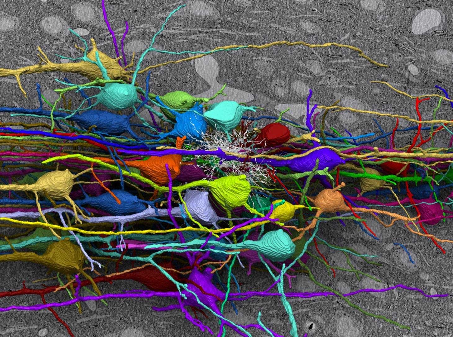 Neuron Electron Microscope