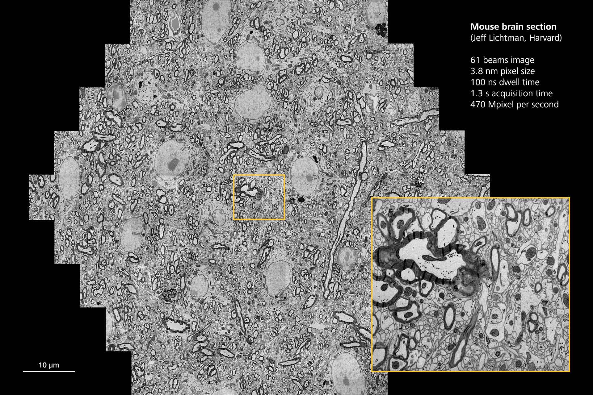 Sección de tejido grande de cerebro de ratón. Cortesía de J. Lichtman, Universidad de Harvard, EE. UU.