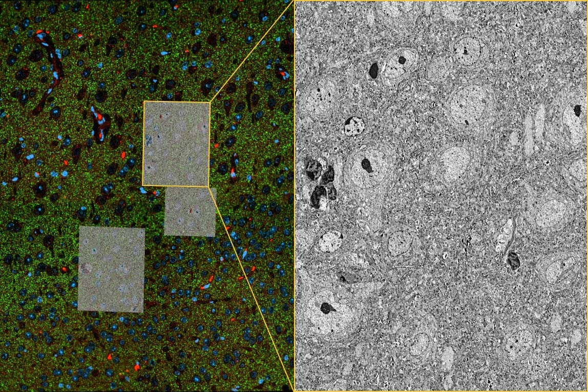 マウス脳の超薄切片。ご提供：M. Ocana, Harvard University, USA