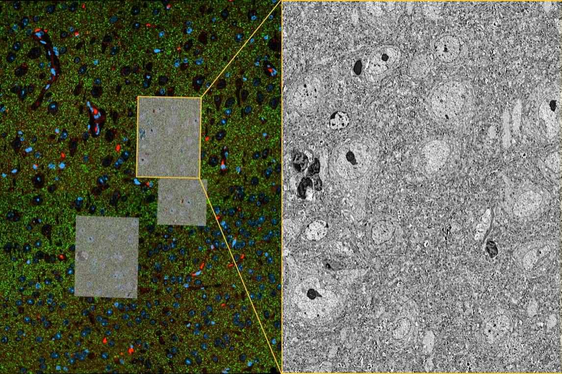 マウス脳の超薄切片。ご提供：M. Ocana, Harvard University, USA