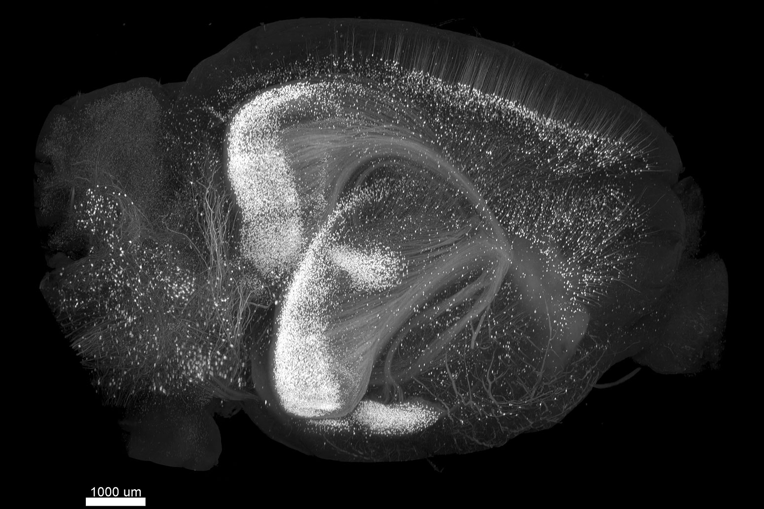 Cerebro de ratón Thy1-EGFP depurado con una versión modificada de iDISCO