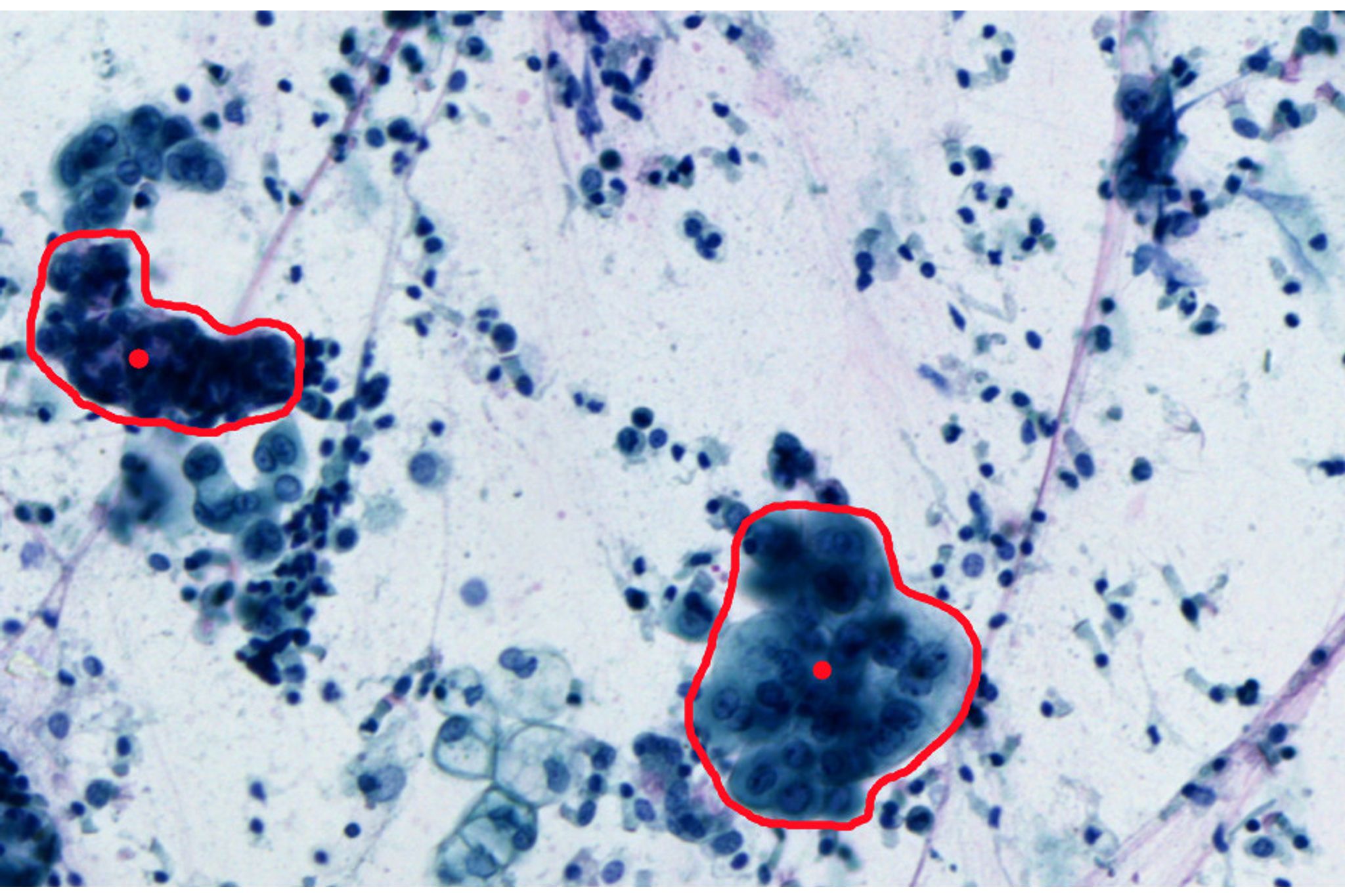 Gentle Laser Microdissection for Cell Clusters, Fixed and Living Cells ...