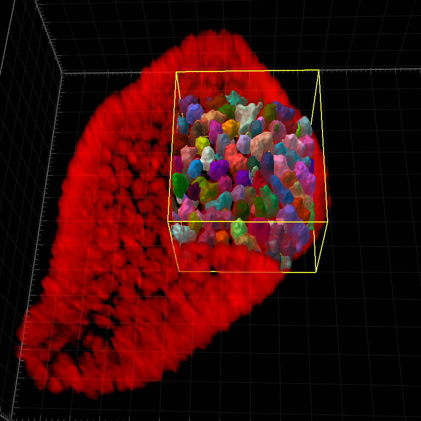3D preview of analysis results in which individual cells in the outer layer of an organoid are visualized in different colors.