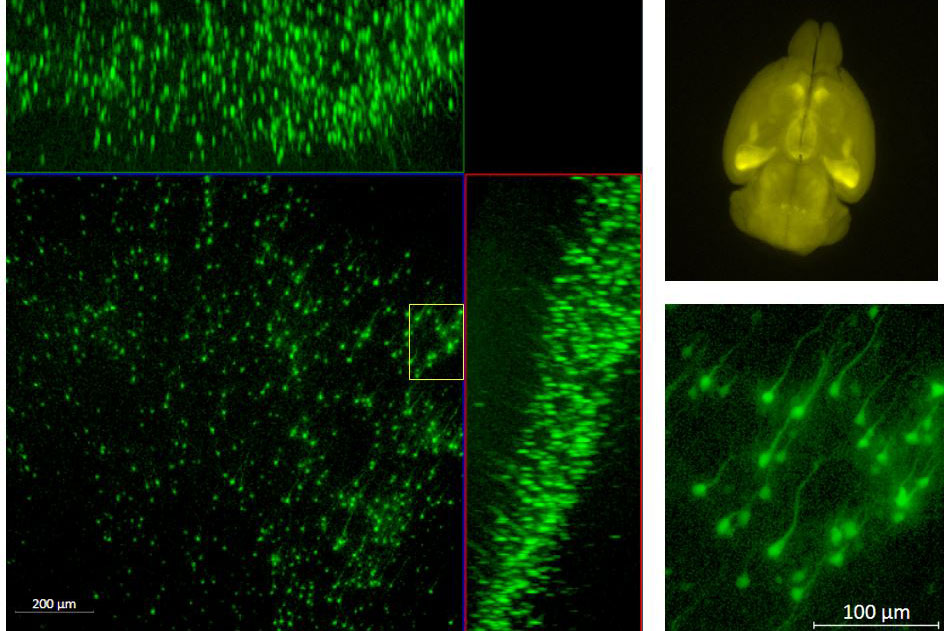 Cleared mouse brain. Upper right: Whole brain overview.