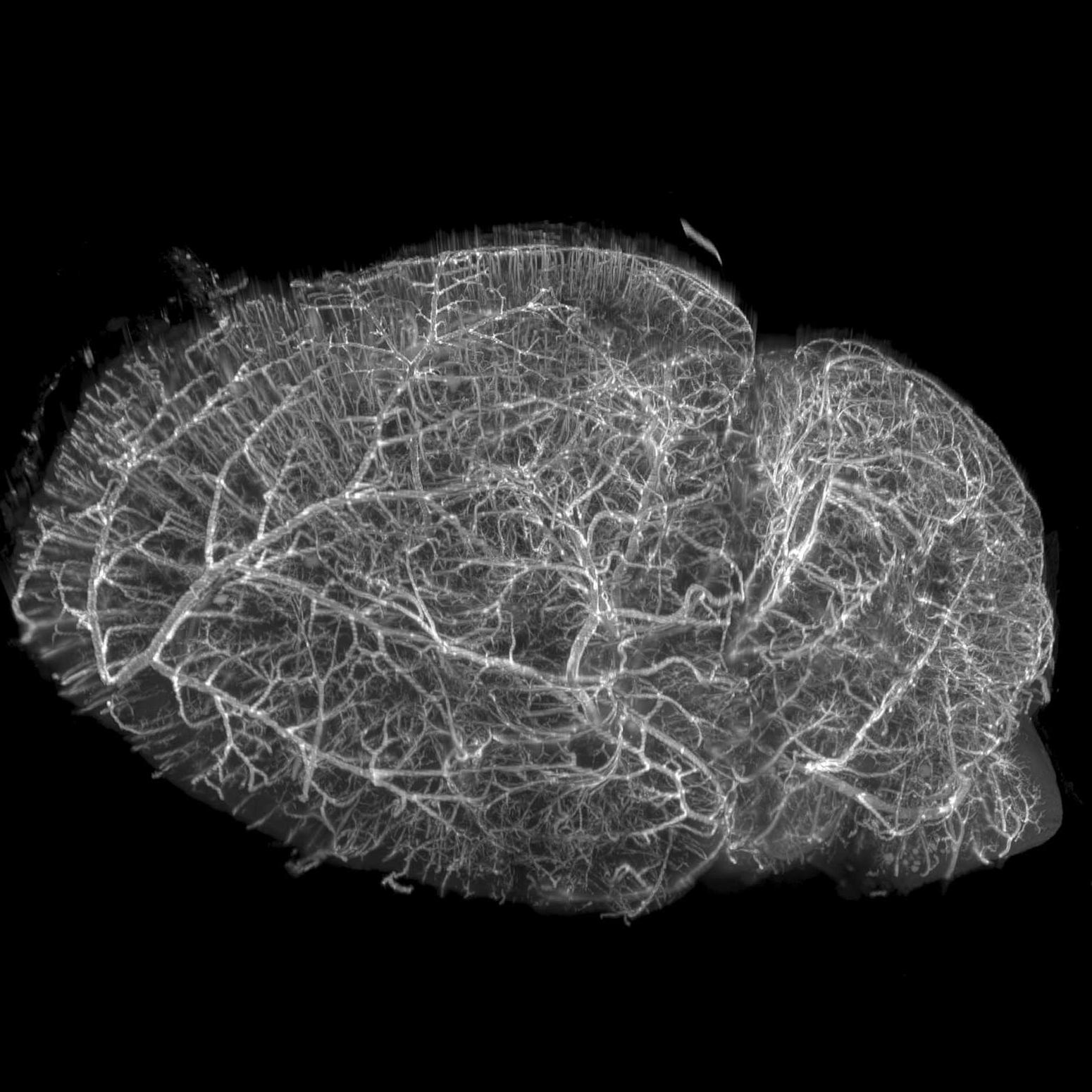 血管壁が明らかになるように脂肪染色したマウス脳、iDISCO+で透明化処理、ライトシート顕微鏡でイメージング。試料ご提供：E. Diel, Harvard University, USA