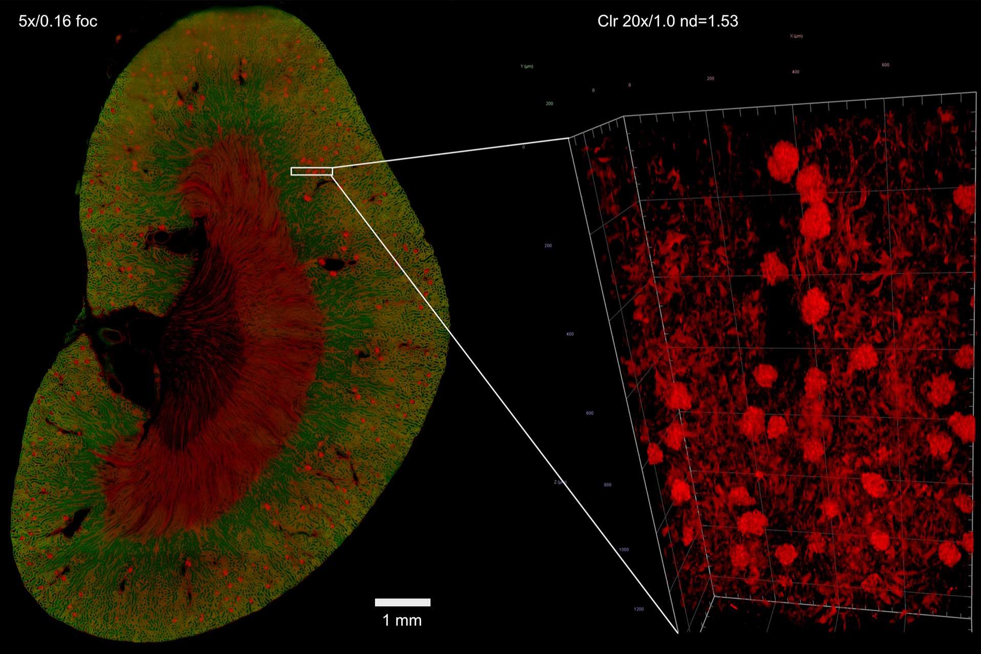 Mouse kidney cleared with iDISCO protocol and imaged with light sheet microscopy. Sample courtesy of U. Roostalu, Gubra, Denmark.