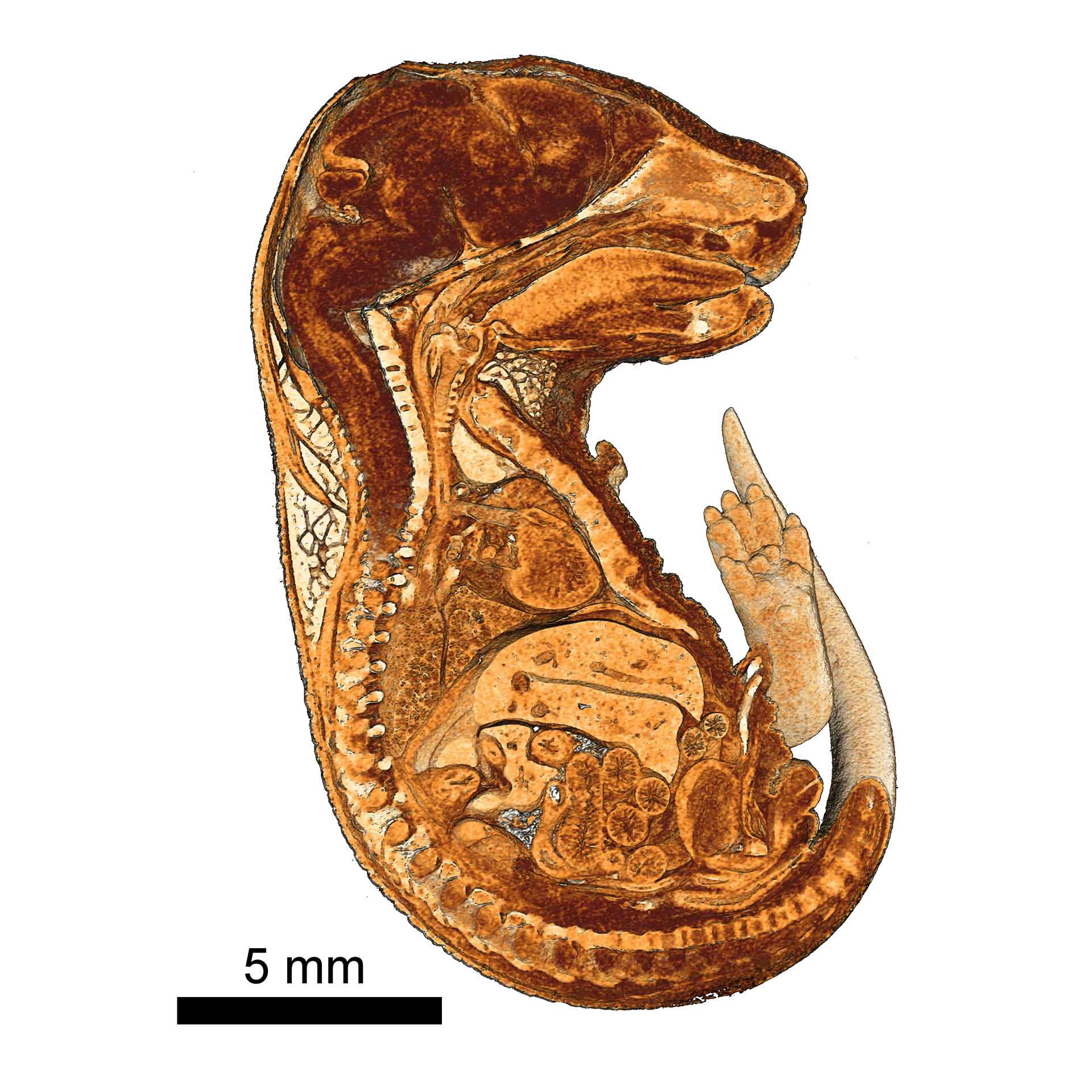 Visualization of various organs in a resin-embedded mouse embryo