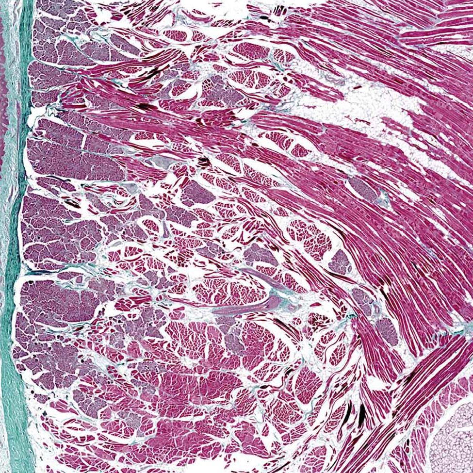 Minisección de tejido de lengua de cerdo teñida con tinción tricrómica de Masson. Muestra cortesía de: Alexander Lomow, Evotec, Alemania