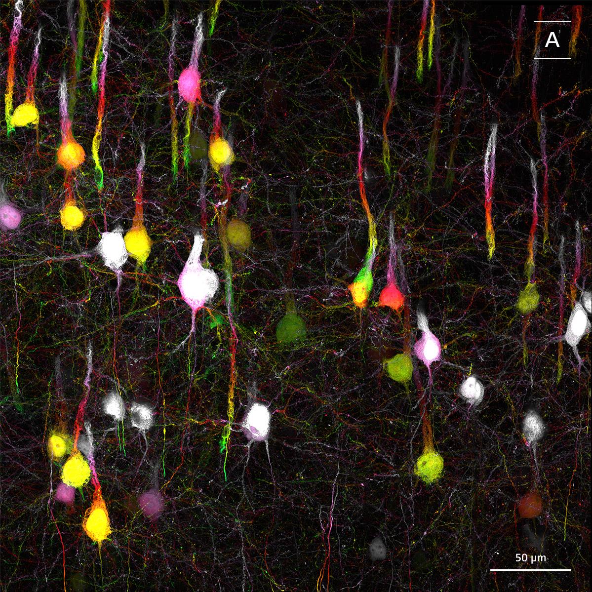 Insert A shows enlarged ROI collected using confocal microscopy with Airyscan super-resolution detector. 