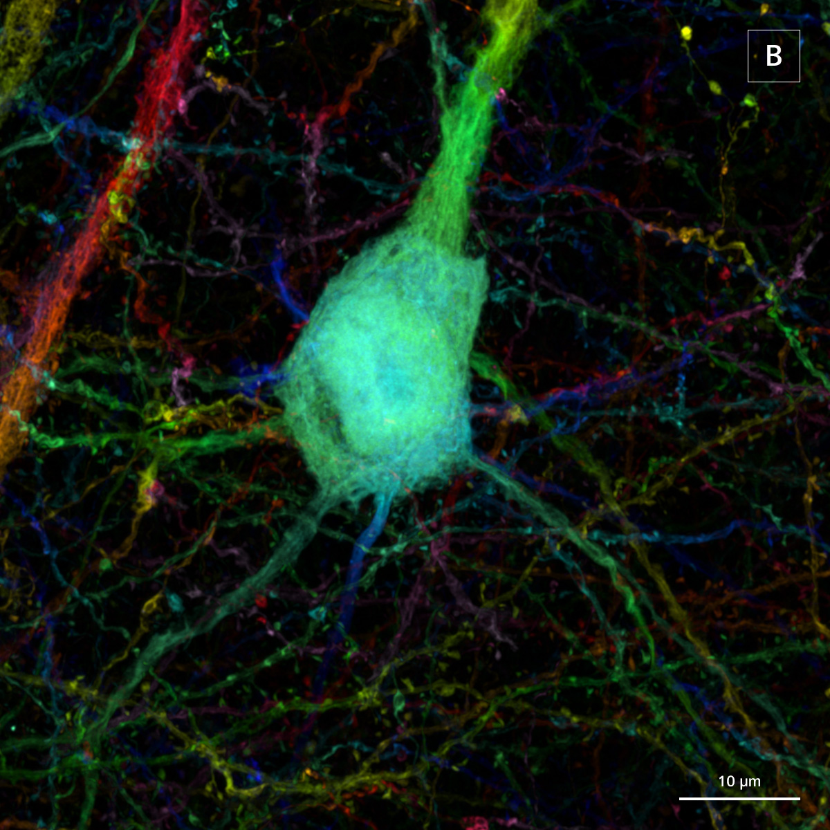 El inserto B muestra una región de interés ampliada captada mediante microscopía confocal con detector de superresolución Airyscan.