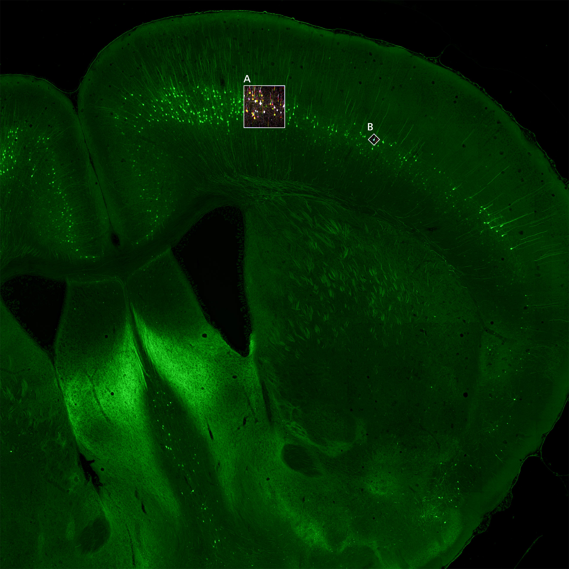 Imagen general de sección de cerebro de ratón captada con un escáner de portaobjetos digital.