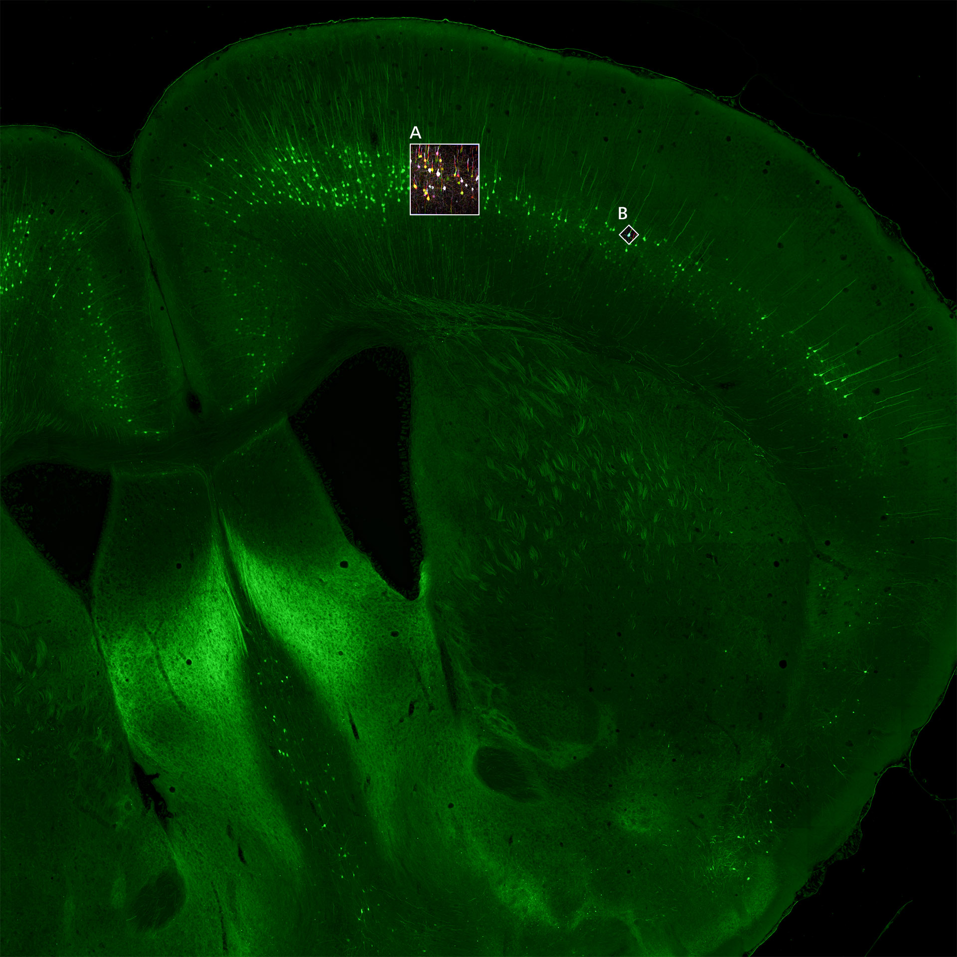 Schnitt durch ein Mäusegehirn, Übersichtsbild, aufgenommen mit einem digitalen Slide-Scanner.