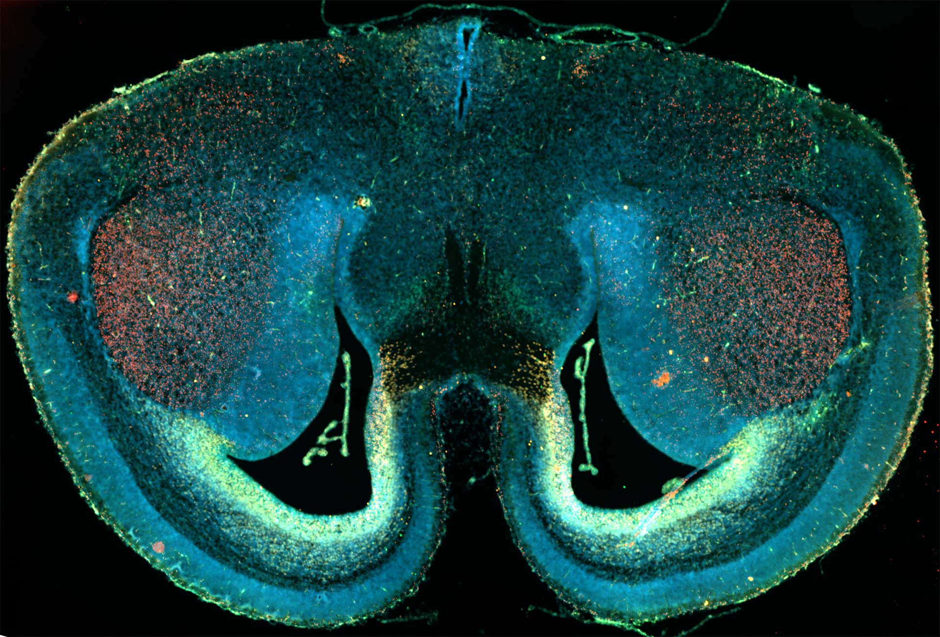 Corte de cerebro de ratón, captado usando microscopía de fluorescencia widefield y función de mosaico. Muestra cortesía de D. Mi, Escuela de Ciencias de la Vida, Universidad de Tsinghua, China