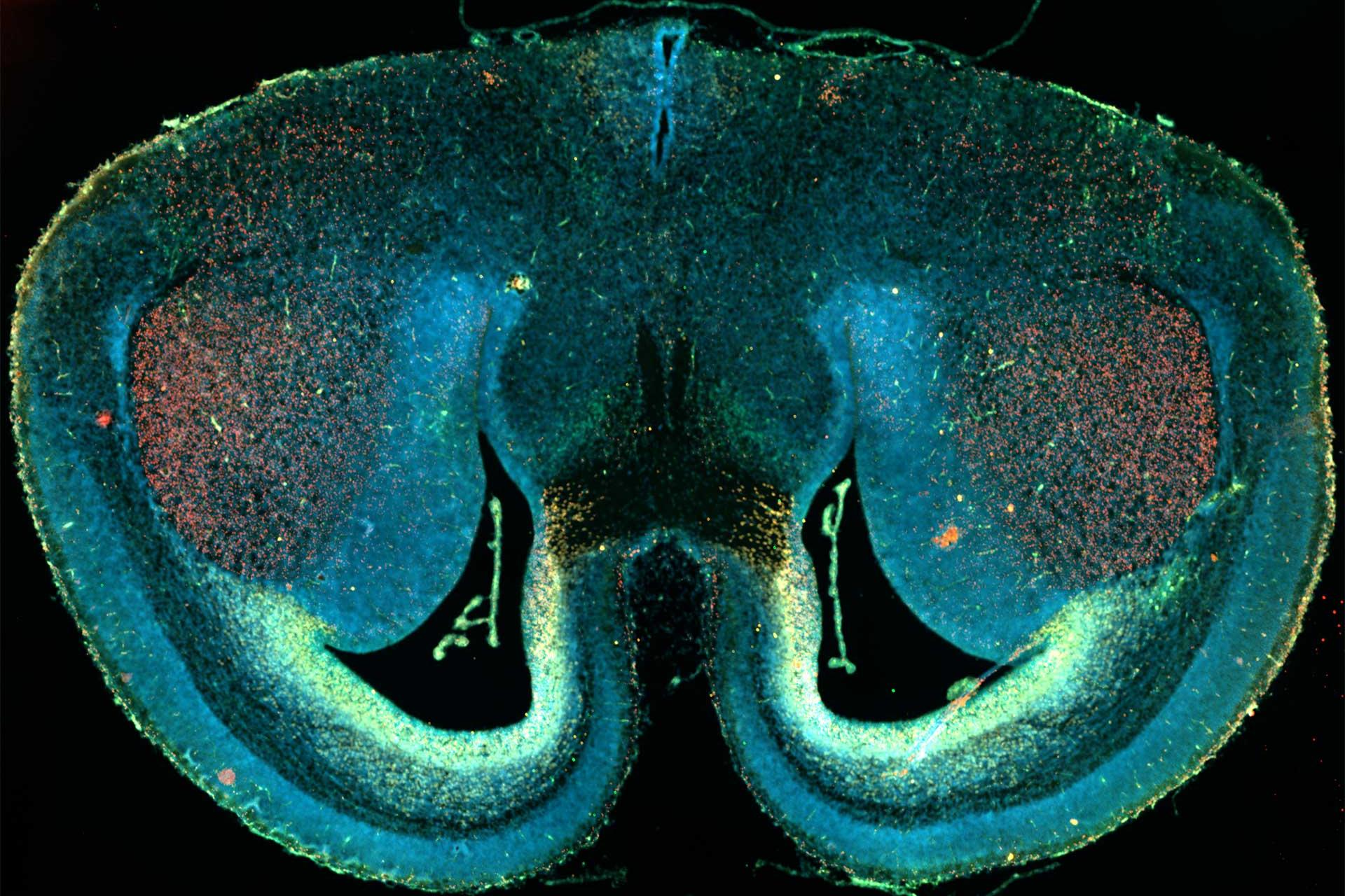 Corte de cerebro de ratón, captado usando microscopía de fluorescencia widefield y función de mosaico. Muestra cortesía de D. Mi, Escuela de Ciencias de la Vida, Universidad de Tsinghua, China