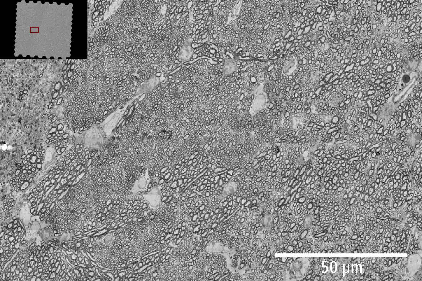 Sección de cerebro de ratón, área de 1 mm². Muestra: cortesía de J. Lichtman, Universidad de Harvard, EE. UU.