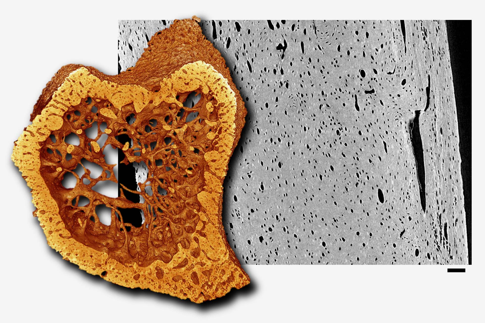 Image d'un tibia de souris capturée à l'aide de ZEISS Xradia Context microCT 